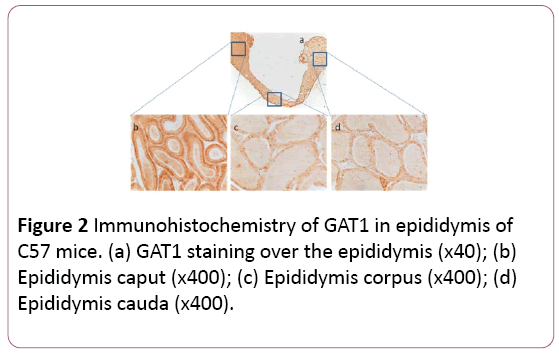 Annals-Clinical-Laboratory-GAT1-epididymis